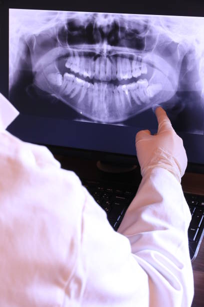 Best Emergency Root Canal Treatment in Columbia, CA